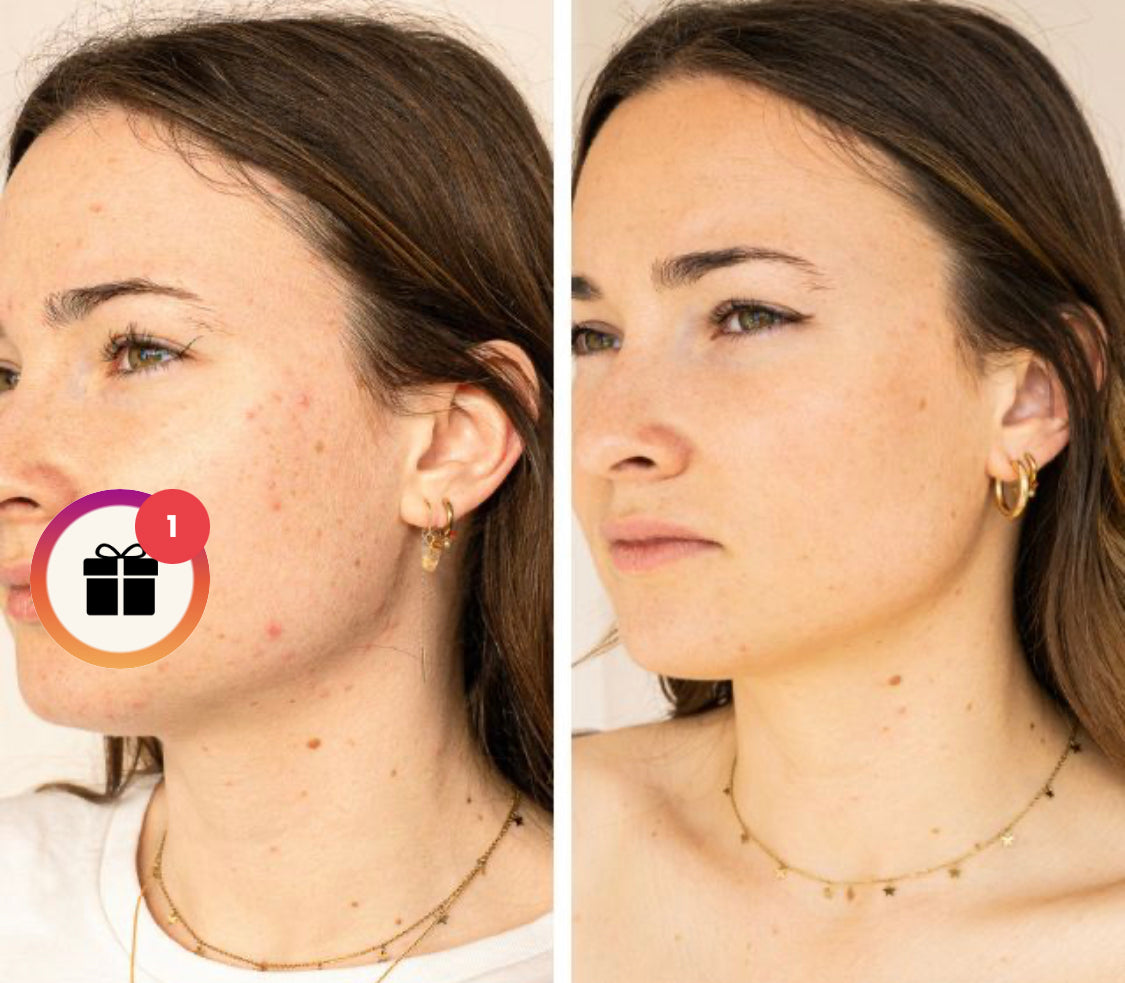 Sérum anti imperfections 🇫🇷